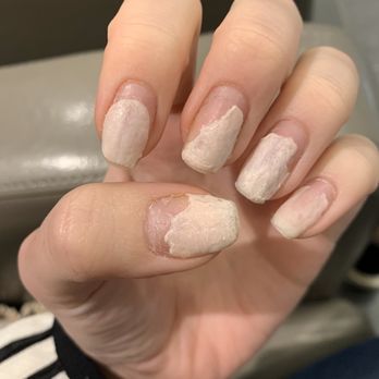 Redmond Nails Salon - One hour after dip manicure removal attempt - Nail Salons Near Me - Redmond, Washington Redmond Nails Salon - One hour after dip manicure removal attempt - Nail Salons Near Me - Redmond, Washington