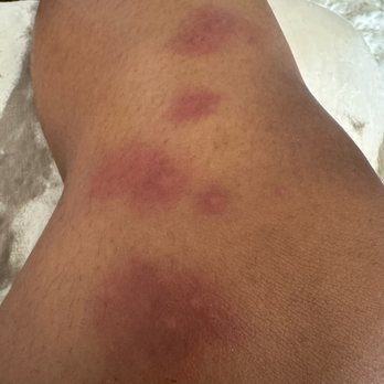 Motel 6 - Spent one night, they have bed bugs - Hotels Near Me - Sun City, California Motel 6 - Spent one night, they have bed bugs - Hotels Near Me - Sun City, California