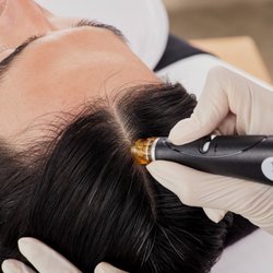 Dolce Derma - Facials Skincare and Lashes - Hydrafacial Scalp Treatment