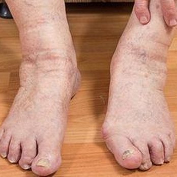 Village Foot Care - untitled - Podiatrists Near Me - Painted Post, New York Village Foot Care - untitled - Podiatrists Near Me - Painted Post, New York