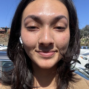 Hiraya Glow Bar - Day after!! - Skin Care Near Me - Poway, California Hiraya Glow Bar - Day after!! - Skin Care Near Me - Poway, California