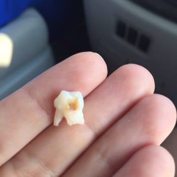 A To Z Pediatric Dentistry - The "guilty" part!  Thankfully and masterfully taken care by Dr. Z. - Pediatric Dentists Near Me - Atlanta, Georgia