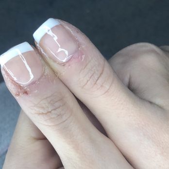 LA Perfection Nails - Lol look at the difference in thumb shapes - Waxing Near Me - Ewing Township, New Jersey LA Perfection Nails - Lol look at the difference in thumb shapes - Waxing Near Me - Ewing Township, New Jersey
