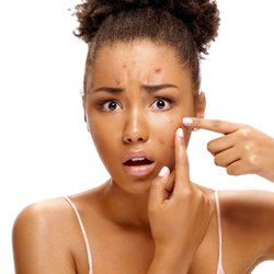 The Acne Facial