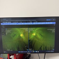 International Opticians - Photos from my eye exam!