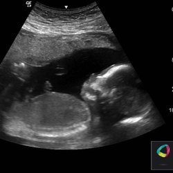 Alinea Medical Imaging - The high quality image I was texted.