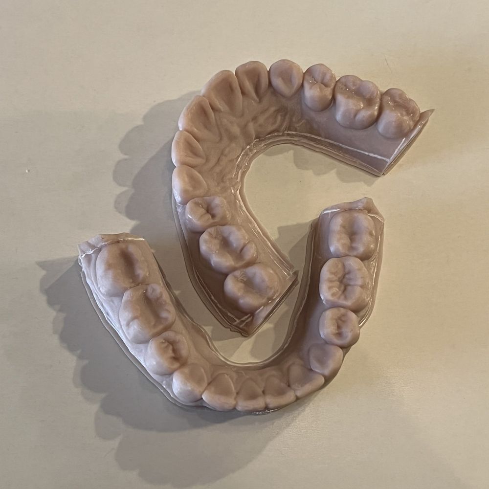 Fagin Orthodontics - 3D models of my teeth - Orthodontists Near Me - Fresno, California Fagin Orthodontics - 3D models of my teeth - Orthodontists Near Me - Fresno, California