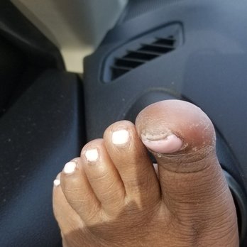 Nail Fetish - Nail not applied properly huge space for bacteria to linger - Nail Salons Near Me - Palm Springs, Florida Nail Fetish - Nail not applied properly huge space for bacteria to linger - Nail Salons Near Me - Palm Springs, Florida