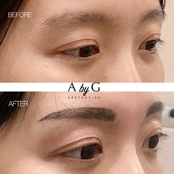Aesthetics by G - Before & After - Skin Care Near Me - Edmonds, Washington