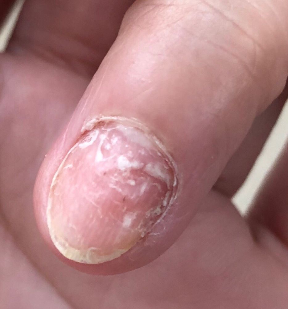 BINH’S NAILS Updated June 2024 16 Reviews 3388 Gateway Blvd