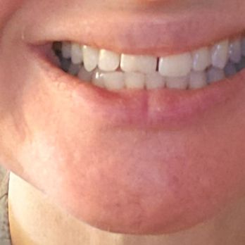 Monica Crooks, DDS - Before smile makeover... - Cosmetic Dentists Near Me - Sacramento, California Monica Crooks, DDS - Before smile makeover... - Cosmetic Dentists Near Me - Sacramento, California