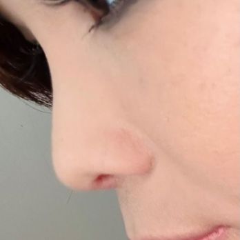Charles S. Lee, MD - Nose: After - Cosmetic Surgeons Near Me - Beverly Hills, California Charles S. Lee, MD - Nose: After - Cosmetic Surgeons Near Me - Beverly Hills, California