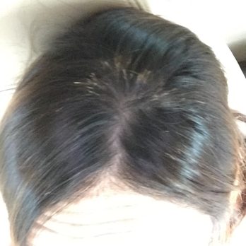 Salon 705 - The way my hair is usually parted! See the breakage??? - Hair Salons Near Me - Brandon, Florida Salon 705 - The way my hair is usually parted! See the breakage??? - Hair Salons Near Me - Brandon, Florida