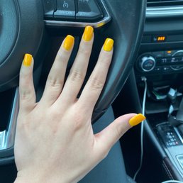 Index finger is the "repaired" nail Index finger is the "repaired" nail