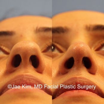 Jae Kim MD, Facial Plastic Surgery - Jae Kim, MD Facial Plastic Surgery - Plastic Surgeons Near Me - Fairfax, Virginia Jae Kim MD, Facial Plastic Surgery - Jae Kim, MD Facial Plastic Surgery - Plastic Surgeons Near Me - Fairfax, Virginia