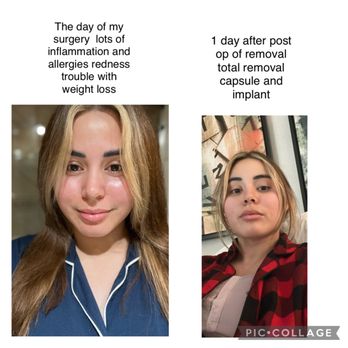 JEFFREY HOEFFLIN, MD FACS - Updated March 2026 - 24 Photos & 43 Reviews ...