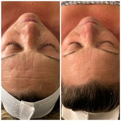 Crystallized Beauty - Lymphatic drainage facial