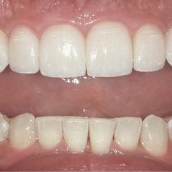 Fine Dentistry of Downtown Orlando - My After