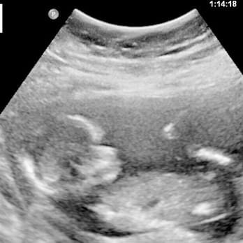 High Risk Pregnancy Center - Henderson - It's a boy! - Obstetricians & Gynecologists Near Me - Henderson, Nevada High Risk Pregnancy Center - Henderson - It's a boy! - Obstetricians & Gynecologists Near Me - Henderson, Nevada