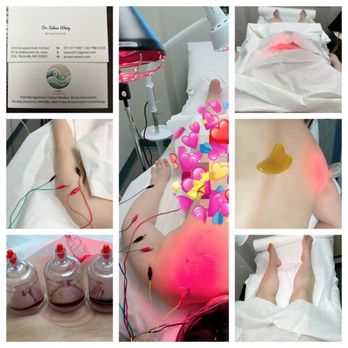 Umi Acupuncture Center - Meridian Bloodletting Therapy - Acupuncture Near Me - Rockville, Maryland Umi Acupuncture Center - Meridian Bloodletting Therapy - Acupuncture Near Me - Rockville, Maryland