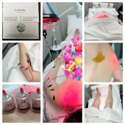 Umi Acupuncture Center - Meridian Bloodletting Therapy