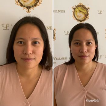 L'AURA WELLNESS MED SPA - Updated May 2026 - 79 Photos & 47 Reviews - 18300  Gridley Rd, Artesia, California - Weight Loss Centers - Phone Number - Yelp