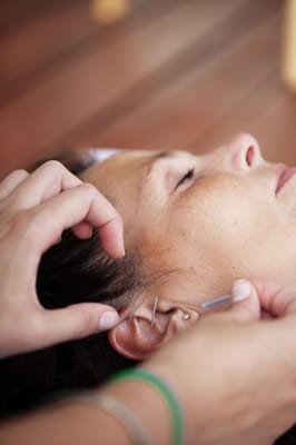 Vineland Community Acupuncture