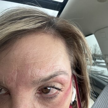 M. Vince' Nail Spa - My eyes after getting an eyebrow wax - Nail Salons Near Me - Denver, Colorado M. Vince' Nail Spa - My eyes after getting an eyebrow wax - Nail Salons Near Me - Denver, Colorado