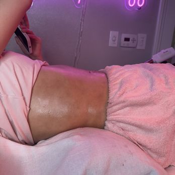 Waisted Body Bar - Post op lipo 360 - Body Contouring Near Me - Oceanside, California Waisted Body Bar - Post op lipo 360 - Body Contouring Near Me - Oceanside, California