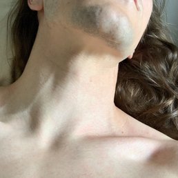Treatment results Treatment results