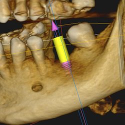 Valley Dental Surgery & Implant Center