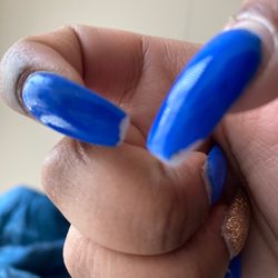 Chipped nails