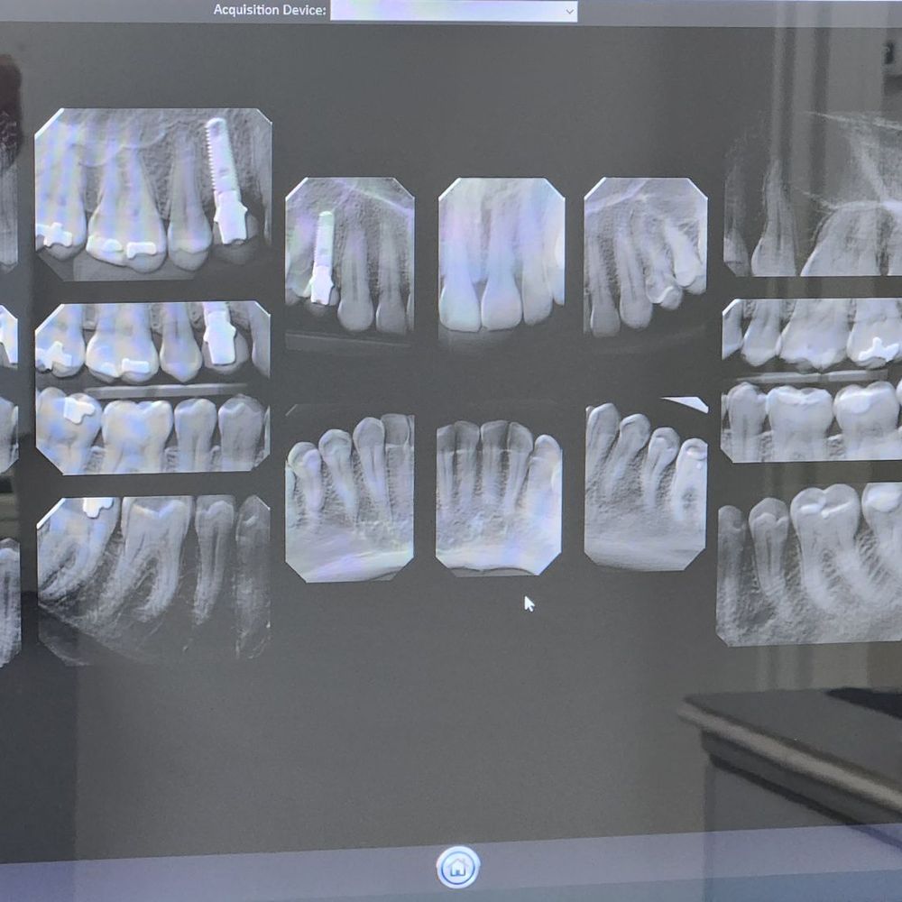 Flossy Dental Group - Dental X-rays - General Dentistry Near Me - Harbor City, California Flossy Dental Group - Dental X-rays - General Dentistry Near Me - Harbor City, California