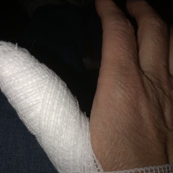 Tuyet Royal Nails - After having nail drilled in 3 spots to drain the infection out. - Nail Salons Near Me - Peoria, Arizona