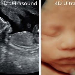 In The Womb View