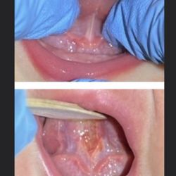 Elena Rumack, DDS MS