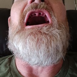 Advantage Dental+ - Ow