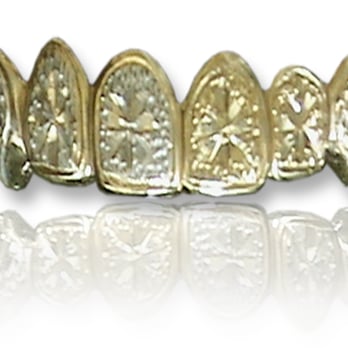 TNB Gold Teeth - tnbgoldteeth #5100033 - Jewelry Near Me - Oakland, California TNB Gold Teeth - tnbgoldteeth #5100033 - Jewelry Near Me - Oakland, California
