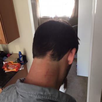 Unacceptable Haircut That Scar Is Tiny Maybe 1 2 And That S