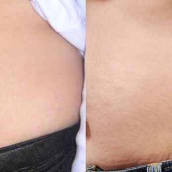 Green Clinic - Skin Care Near Me - Toronto, Ontario Green Clinic - Skin Care Near Me - Toronto, Ontario