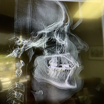 Ventura County Orthodontics - Digital xrays - Orthodontists Near Me - Oxnard, California Ventura County Orthodontics - Digital xrays - Orthodontists Near Me - Oxnard, California