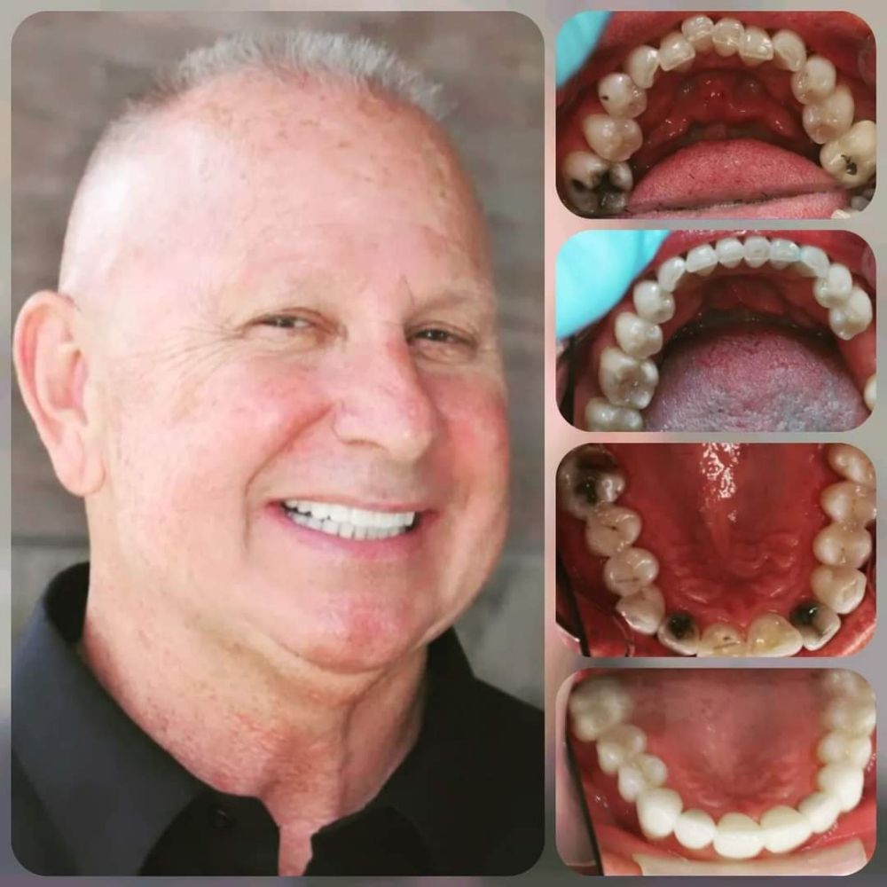 NU SMILE ROSEVILLE DENTAL Updated October 2024 44 Photos & 38 Reviews 1420 Blue Oaks Blvd