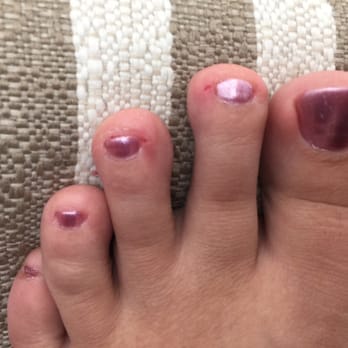 T & L Nail Spa - Filed way to short and broke skin on two toes. - Nail Salons Near Me - Pensacola, Florida T & L Nail Spa - Filed way to short and broke skin on two toes. - Nail Salons Near Me - Pensacola, Florida