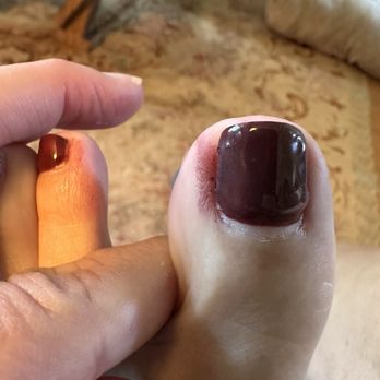 Lovely Nails - Zoom in see the mistakes five toes in all - Nail Salons Near Me - Punta Gorda, Florida