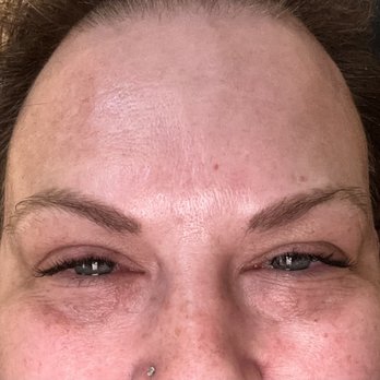 Wildflower Aesthetics & Wellness - Smiling - IV Hydration Near Me - Windsor, California
