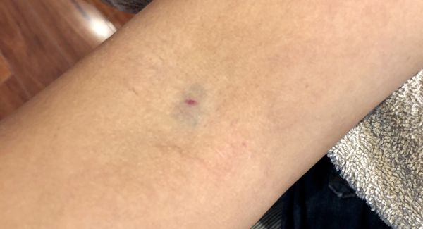 LABCORP - Updated February 2026 - 21 Photos & 69 Reviews - 10215 ...