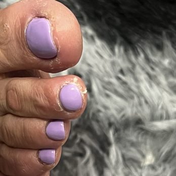 Glitz N Glam - Sorry but I had to show how they left me :/ - Nail Salons Near Me - San Francisco, California Glitz N Glam - Sorry but I had to show how they left me :/ - Nail Salons Near Me - San Francisco, California