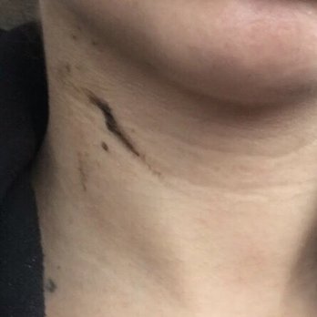 Chicago Microblading - Ink from Havy poorly filling in my brows - Permanent Makeup Near Me - Schaumburg, Illinois
