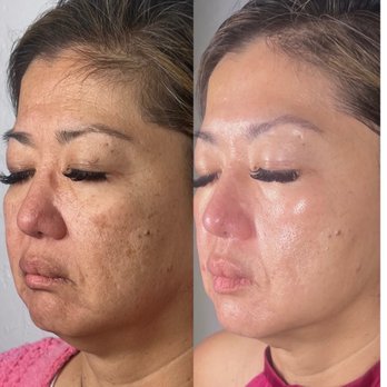Sheila Marie Aesthetics - Before and after - Eyelash Service Near Me - San Mateo, California Sheila Marie Aesthetics - Before and after - Eyelash Service Near Me - San Mateo, California