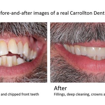 Carrollton Dentistry - General Dentistry Near Me - Carrollton, Texas Carrollton Dentistry - General Dentistry Near Me - Carrollton, Texas